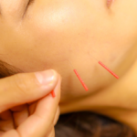 さかい接骨院　熱海